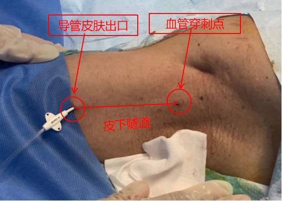 微信图片_20220806122436.jpg 微信图片_20220806122436.jpg